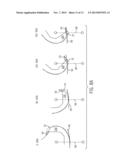 PROSTHESIS AND METHOD FOR USING PROSTHESIS TO FACILITATE DEEP KNEE FLEXION diagram and image