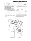 PARTIAL OR COMPLETE PROSTHETIC REPLACEMENT ARTHROPLASTY OF THE DISTAL     RADIOULNAR JOINT diagram and image