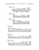 PARTIAL OR COMPLETE PROSTHETIC REPLACEMENT ARTHROPLASTY OF THE DISTAL     RADIOULNAR JOINT diagram and image