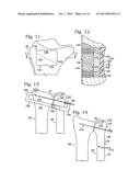 PARTIAL OR COMPLETE PROSTHETIC REPLACEMENT ARTHROPLASTY OF THE DISTAL     RADIOULNAR JOINT diagram and image