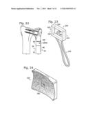 PARTIAL OR COMPLETE PROSTHETIC REPLACEMENT ARTHROPLASTY OF THE DISTAL     RADIOULNAR JOINT diagram and image