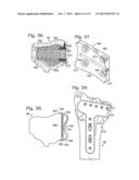 PARTIAL OR COMPLETE PROSTHETIC REPLACEMENT ARTHROPLASTY OF THE DISTAL     RADIOULNAR JOINT diagram and image