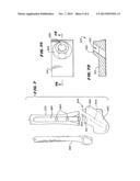 ANKLE REPLACEMENT SYSTEM diagram and image