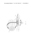 Blind Hole Anchor, Cable Tie and Method of Securing an Anchor in a Blind     Hole diagram and image