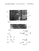 LEAD STRUCTURES WITH VERTICAL OFFSETS diagram and image