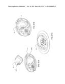 Adhesive and Peripheral Systems and Methods for Medical Devices diagram and image