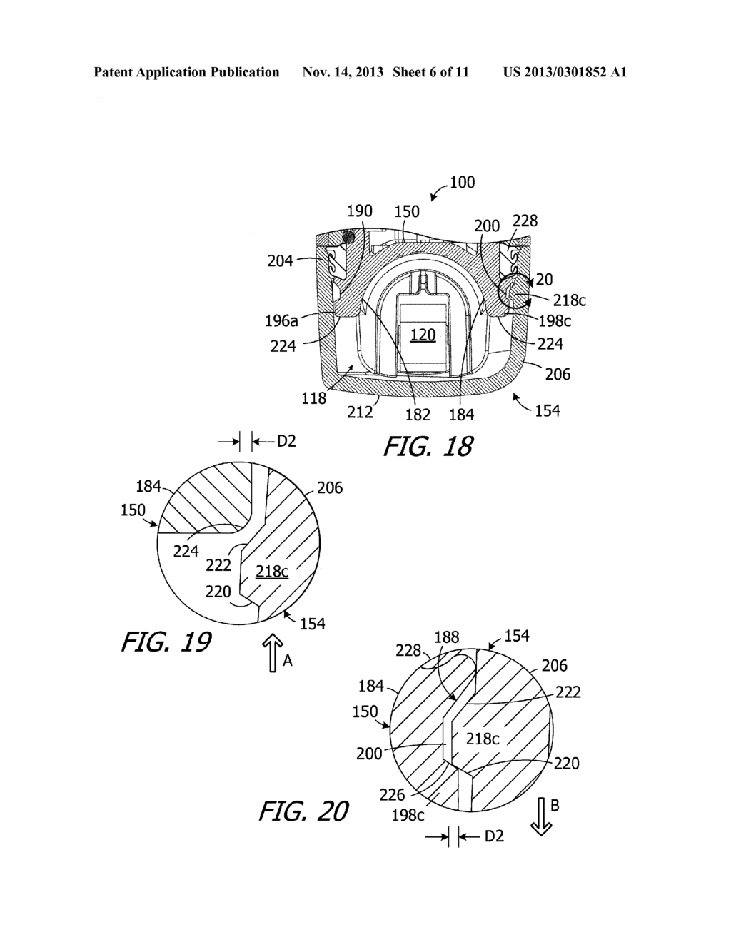 SOUND PROCESSOR HOUSINGS, SOUND PROCESSORS AND IMPLANTABLE COCHLEAR     STIMULATION SYSTEMS INCLUDING THE SAME - diagram, schematic, and image 07