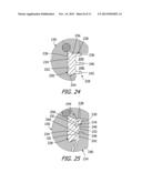 SOUND PROCESSOR HOUSINGS, SOUND PROCESSORS AND IMPLANTABLE COCHLEAR     STIMULATION SYSTEMS INCLUDING THE SAME diagram and image