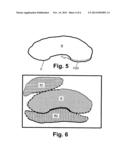 CONTOUR DELINEATION FOR RADIATION THERAPY PLANNING WITH REAL-TIME CONTOUR     SEGMENT IMPACT RENDERING diagram and image