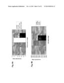 ANTAGONIST ANTIBODY FOR THE TREATMENT OF CANCER diagram and image