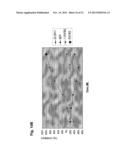 ANTAGONIST ANTIBODY FOR THE TREATMENT OF CANCER diagram and image