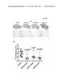 MODULATORS OF IL-12 AND/OR IL-23 FOR THE PREVENTION OR TREATMENT OF     ALZHEIMER S DISEASE diagram and image