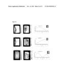 Co-Delivery Of Stimulatory And Inhibitory Factors To Create Temporally     Stable And Spatially Restricted Zones diagram and image