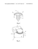 TRACTION-MEANS TENSIONING DEVICE HAVING A SECURING ELEMENT, AND INTERNAL     COMBUSTION ENGINE HAVING SUCH A TRACTION-MEANS TENSIONING DEVICE diagram and image