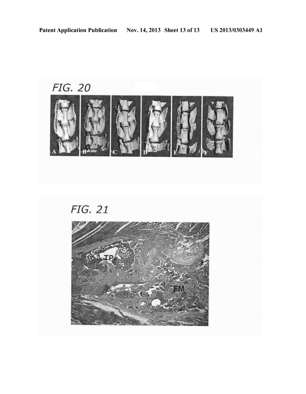 SURGICAL APPLICATIONS FOR BMP BINDING PROTEIN - diagram, schematic, and image 14