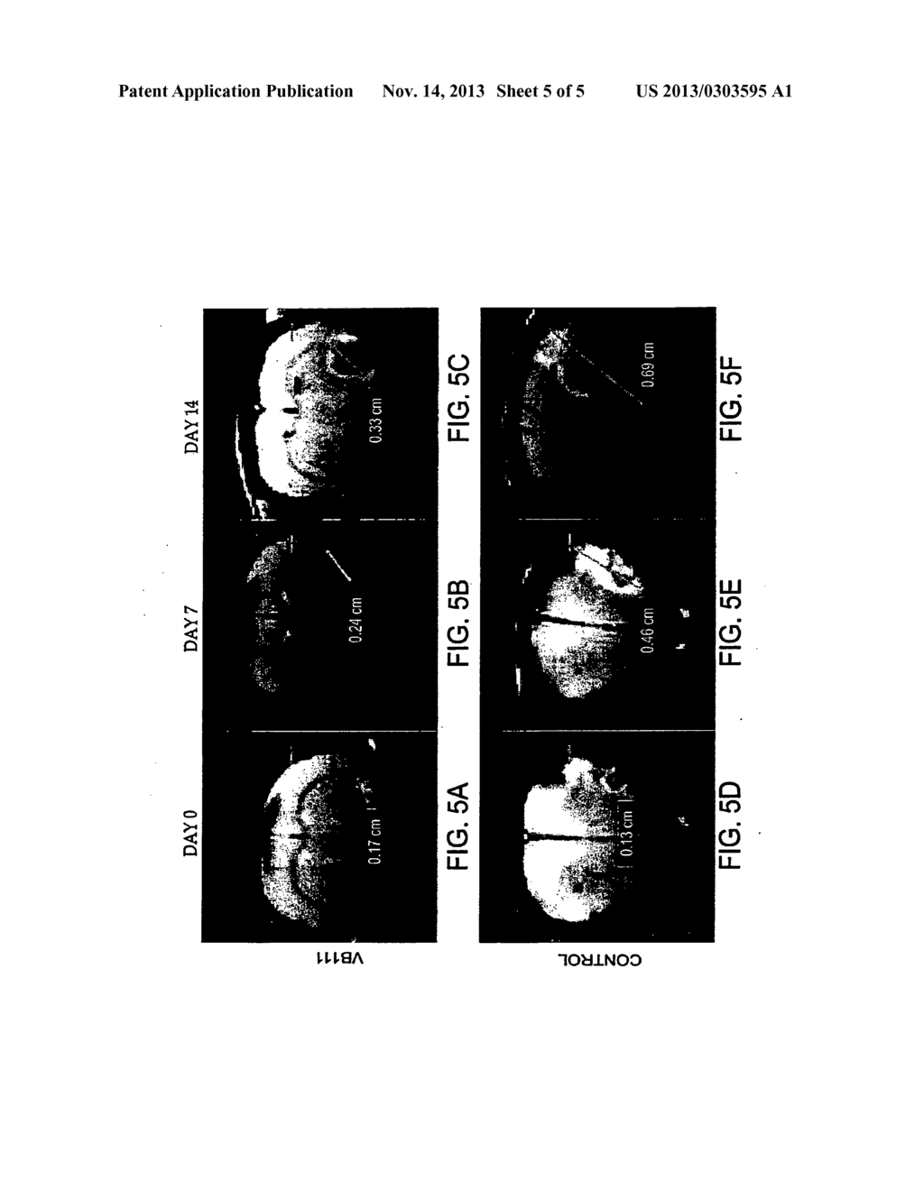 Compositions and Methods for Treating Glioblastoma GBM - diagram, schematic, and image 06