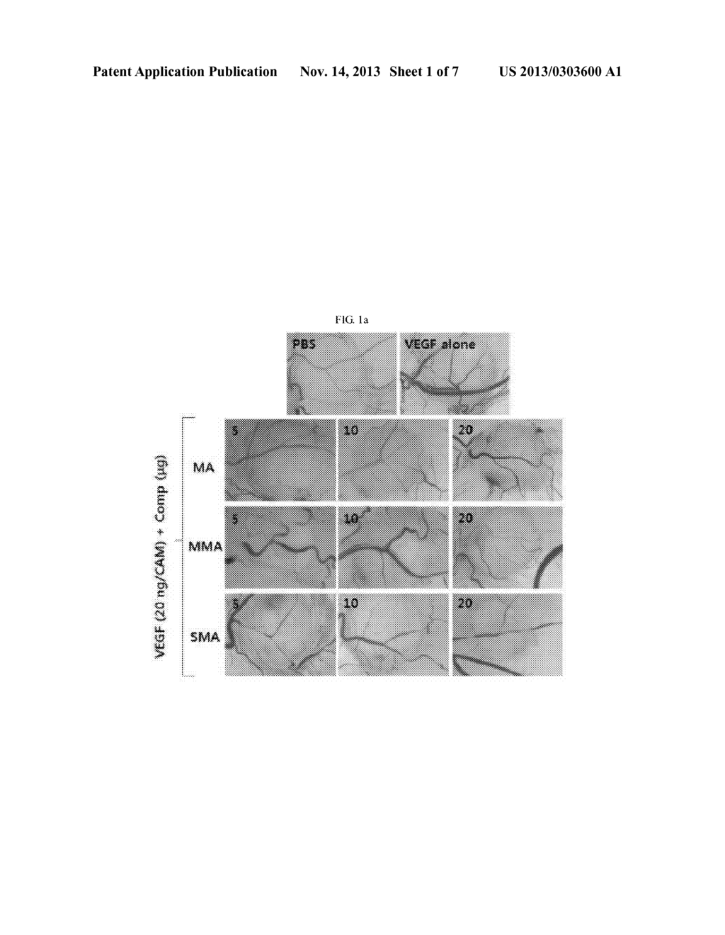 ANTI-ANGIOGENIC COMPOSITION CONTAINING MACROLACTIN A AND A DERIVATIVE     THEREOF AS ACTIVE INGREDIENTS - diagram, schematic, and image 02