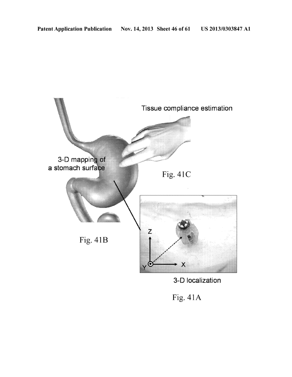 SYSTEM AND METHOD TO MAGNETICALLY ACTUATE A CAPSULE ENDOSCOPIC ROBOT FOR     DIAGNOSIS AND TREATMENT - diagram, schematic, and image 47