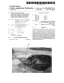 PDMS-Based Stretchable Multi-Electrode and Chemotrode Array for Epidural     and Subdural Neuronal Recording, Electrical Stimulation and Drug Delivery diagram and image