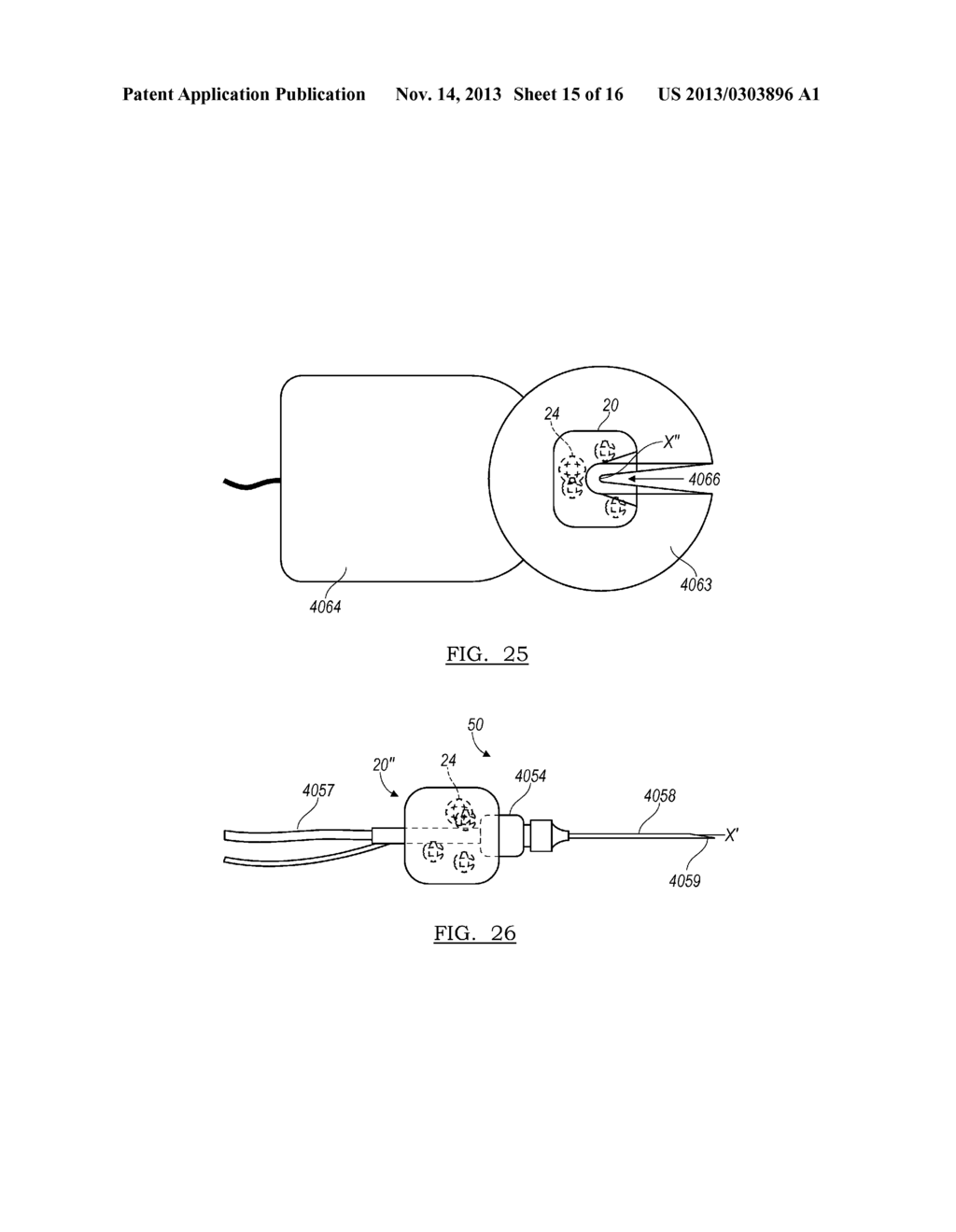 Method And Apparatus For Guiding An External Needle To An Implantable     Device - diagram, schematic, and image 16