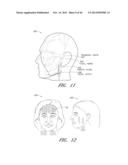 Systems for Cosmetic Treatment diagram and image