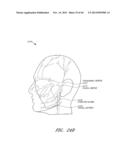 Systems for Cosmetic Treatment diagram and image