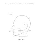 Systems for Cosmetic Treatment diagram and image