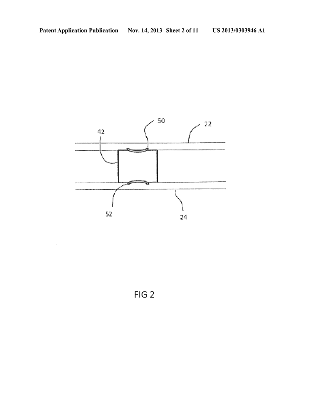 WEARABLE ARTICLE FOR DETECTING AN IMPACT AND METHOD OF OPERATION - diagram, schematic, and image 03