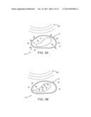 SYSTEMS AND METHODS FOR DELIVERY OF A THERAPEUTIC AGENT diagram and image