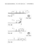 SYSTEMS AND METHODS FOR DELIVERY OF A THERAPEUTIC AGENT diagram and image