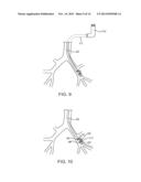 SYSTEMS AND METHODS FOR DELIVERY OF A THERAPEUTIC AGENT diagram and image