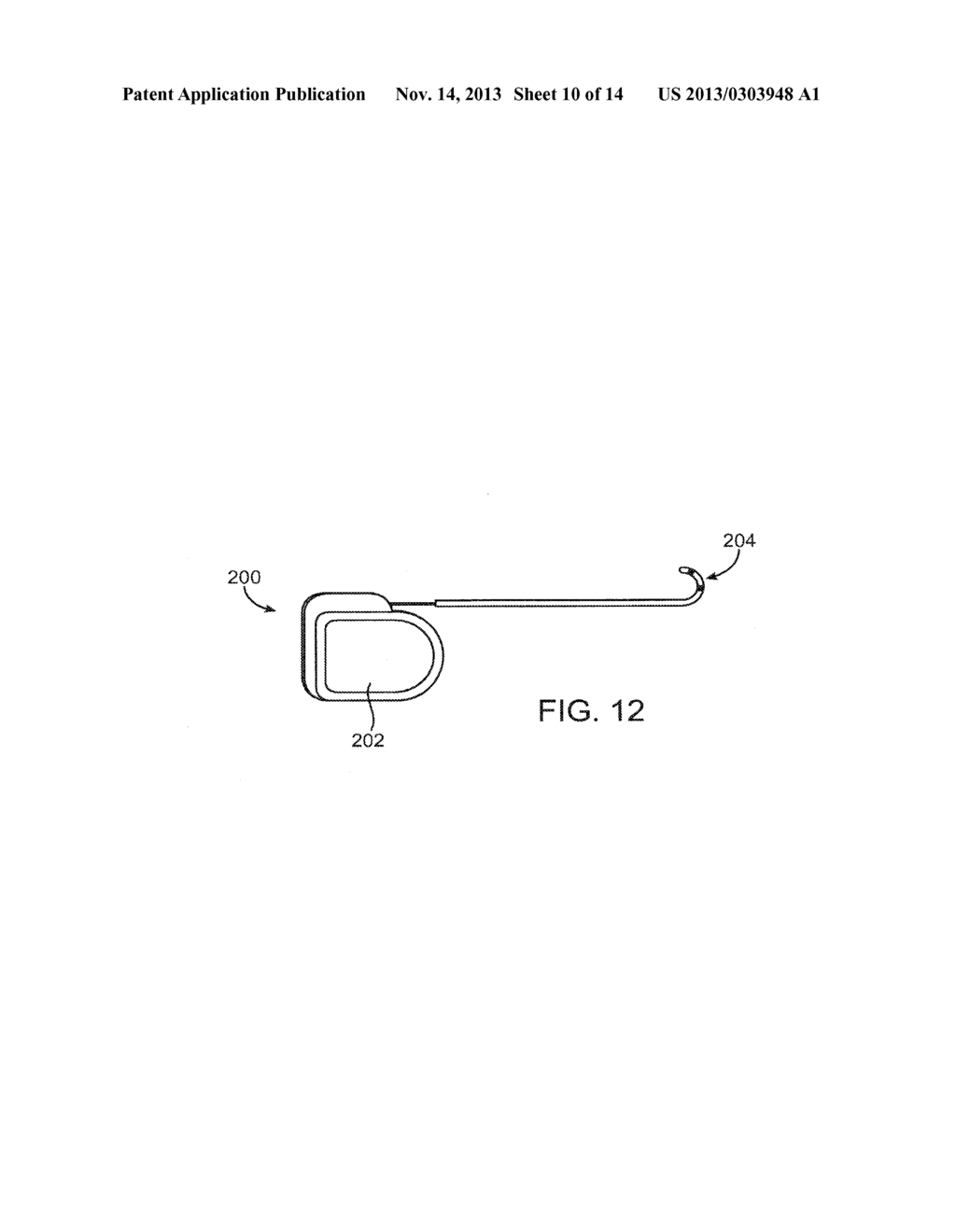 SYSTEMS AND METHODS FOR DELIVERY OF A THERAPEUTIC AGENT - diagram, schematic, and image 11