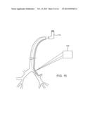 SYSTEMS AND METHODS FOR DELIVERY OF A THERAPEUTIC AGENT diagram and image