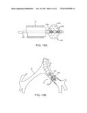 SYSTEMS AND METHODS FOR DELIVERY OF A THERAPEUTIC AGENT diagram and image