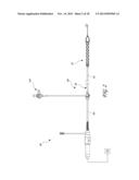 SHEATH SYSTEM FOR CATHETER PUMP diagram and image