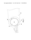 SHEATH SYSTEM FOR CATHETER PUMP diagram and image