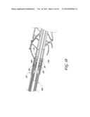 SHEATH SYSTEM FOR CATHETER PUMP diagram and image