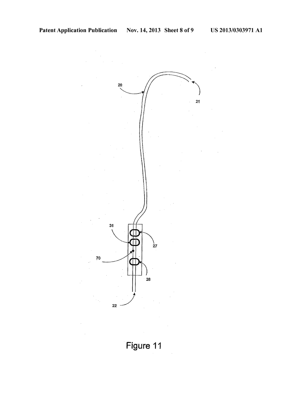 CATHETER AND SHUNT SYSTEM INCLUDING THE CATHETER - diagram, schematic, and image 09