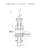 Vascular Access Catheter Anchor and Access Valve diagram and image