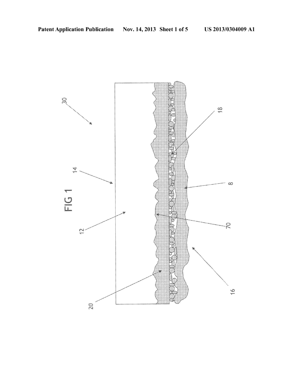 Unitary Absorbent Core - diagram, schematic, and image 02