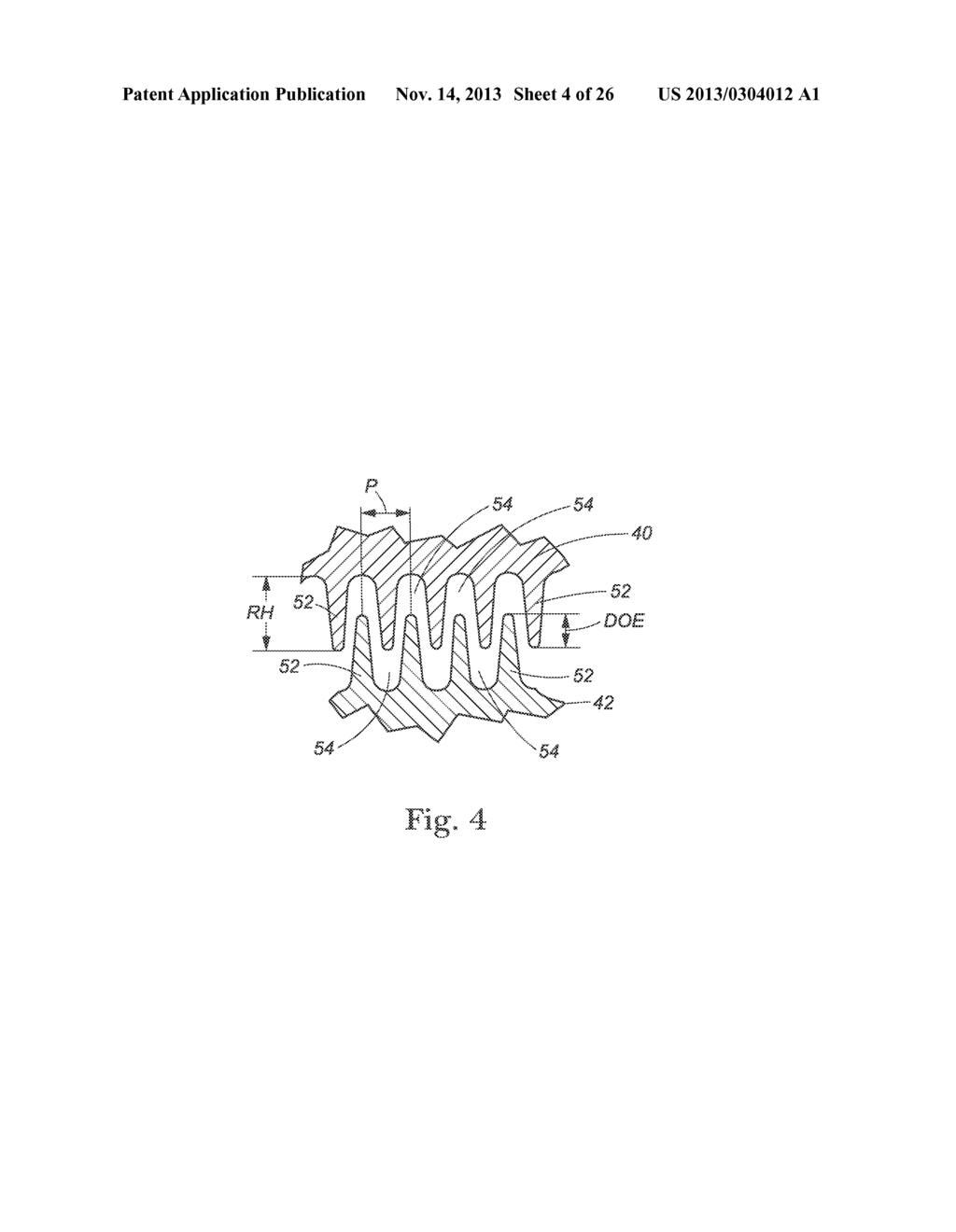 DISPOSABLE ABSORBENT ARTICLE - diagram, schematic, and image 05