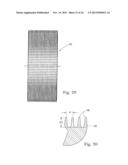 DISPOSABLE ABSORBENT ARTICLE diagram and image