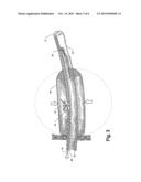 BALLOON CATHETER diagram and image