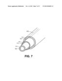 APPARATUS FOR EVALUATING THE INTEGRITY OF A UTERINE CAVITY diagram and image