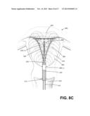 APPARATUS FOR EVALUATING THE INTEGRITY OF A UTERINE CAVITY diagram and image