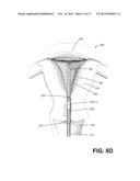 APPARATUS FOR EVALUATING THE INTEGRITY OF A UTERINE CAVITY diagram and image