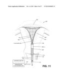 APPARATUS FOR EVALUATING THE INTEGRITY OF A UTERINE CAVITY diagram and image