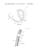 Multi-Electrode Catheter Assemblies for Renal Neuromodulation and     Associated Systems and Methods diagram and image