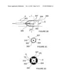 METHODS AND APPARATUS FOR PERFORMING RENAL NEUROMODULATION VIA CATHETER     APPARATUSES HAVING INFLATABLE BALLOONS diagram and image