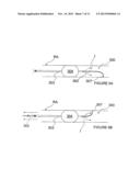 METHODS AND APPARATUS FOR PERFORMING RENAL NEUROMODULATION VIA CATHETER     APPARATUSES HAVING INFLATABLE BALLOONS diagram and image